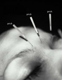 Bolile care pot fi prevenite cu ajutorul acupuncturii