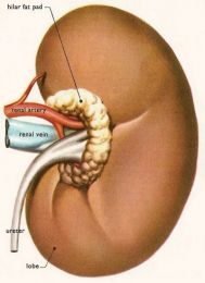 Cauzele de ordin renal ale litiazei urinare