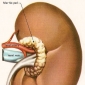 Cauzele de ordin renal ale litiazei urinare