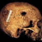 Cazul ceasornicarului Pel: concluziile cercetarii cadavrului deshumat de catre medicii specalisti