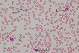 Despre sange - elementele figurate eritrocite, leucocite, trombocite