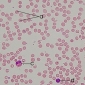 Despre sange - elementele figurate eritrocite, leucocite, trombocite