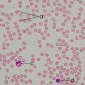 Despre sange - elementele figurate eritrocite, leucocite, trombocite