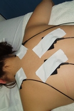 Electroterapia