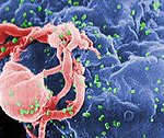 Referat - Virusul HIV